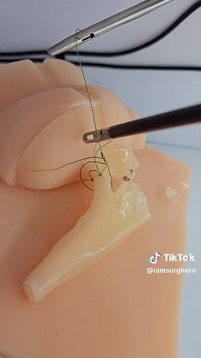 Train in Appendectomy Procedure with Advanced Simulator