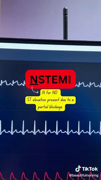 🫀STEMI vs NSTEMI MI #medtok #myocardialinfarction #heartattack #nurse #nursingschool #stemi