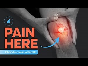 Chondromalacia Patellae | Runner’s Knee | Knee Pain Exercises | Knee Cap Pain
