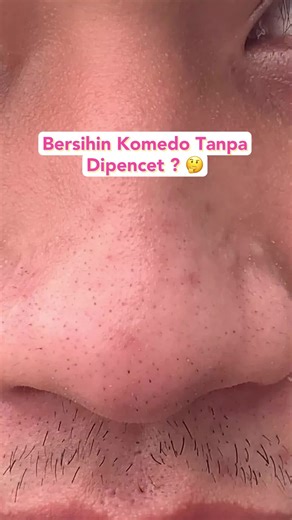 Bersihin Komedo Tanpa Dipencet with Hanasui Power Peeling Serum