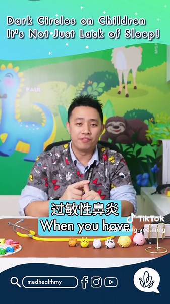 Understanding Allergic Rhinitis and Dark Eye Circles