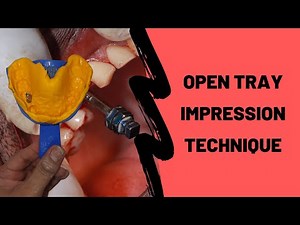 How To Take an Open Tray Implant Impression? DEMO