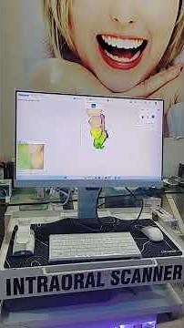 How Intraoral 3D Scanner works? Demo #dramitpatil #ishwarpur