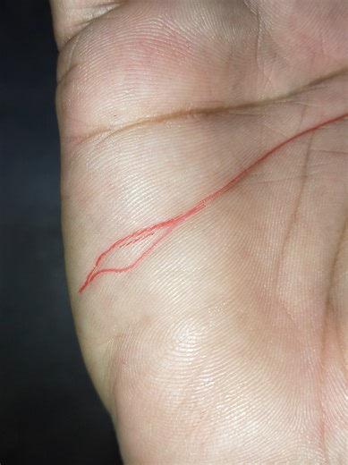 Understanding the Big Island on the Brain Line