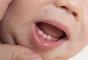 10 Signs & Symptoms of Teething in Babies