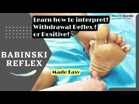 Babinski reflex-detailed assessment #Triplefelxionbabinski #withdrawlreflex #plantartest #neurology