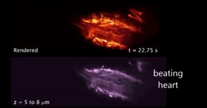 "SCAPE" microscope offers faster and simpler imaging of freely moving samples