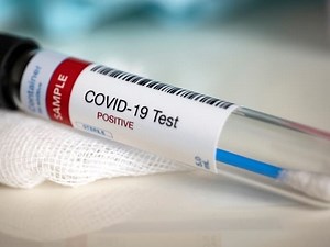 CVS To Offer Drive-Through Coronavirus Tests In Gwinnett