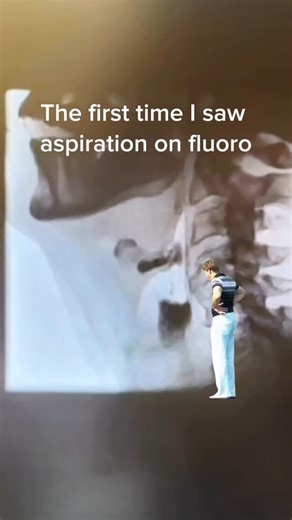 Tim Stockdale, SLPD, CCC-SLP on Instagram: "Well, wood’juh? #dysphagia #slp #slplife #medicalslp #medslp #slp2be #slpeeps #slptobe #mbss #vfss #fluoro"