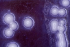 Ubiquinol CoQ10 | Coenzyme Q10 | Igennus Healthcare Nutrition