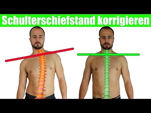 Schulterschiefstand beheben | Krumme Wirbelsäule + Brustkorb aufrichten
