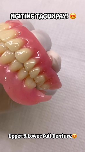 41K views · 357 reactions | Upper & Lower Full Denture!!! | Denture Denture | Facebook