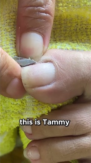 Cuticle Care 101 The Essential First Step