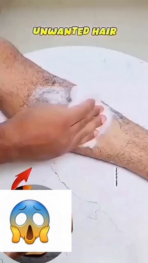 Remove Unwanted Body Hair At Home Easily Without Pain #hairremoval #unwantedhairremoval #❤️ | anjanaverma.19