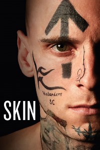Skin Summary, Trailer, Cast, Where to Watch and More
