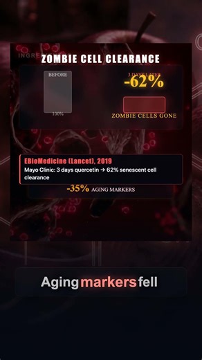 Quercetin: 62% of Zombie Cells Eliminated in 3 Days