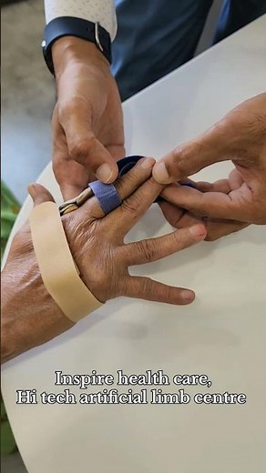 Dynamic hand splint for Rheumatoid arthritis #orthosis #splint #lifehacks #effectivesolutions