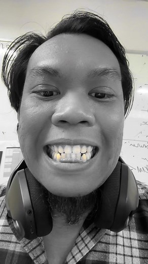 How to Talk About Yellow Teeth with an Office Mate