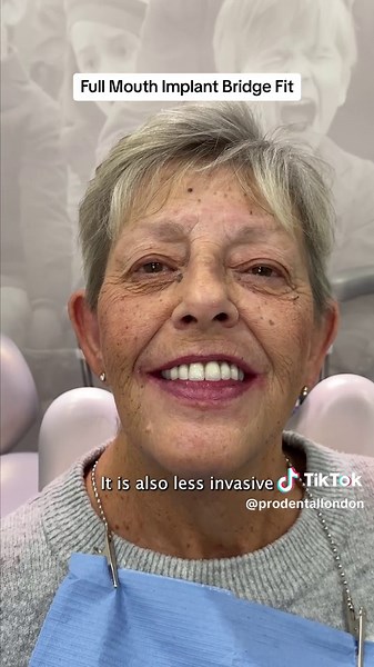 #allon4 #allonfourdentalimplants #allonfourimplants