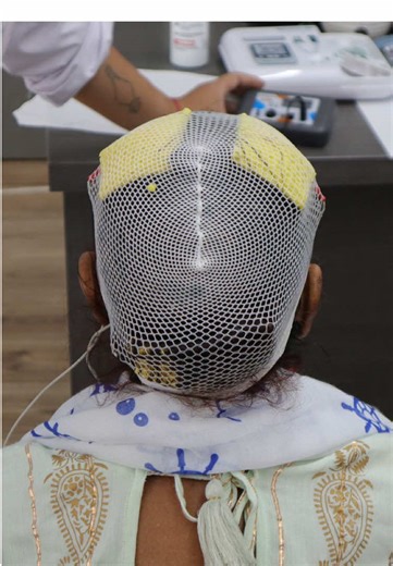 Hear from Bereket, who brought his mother from Sweden to SOZO Brain Center in Cyprus for supporting treatment for different conditions, including tremors and swelling in her leg. 🧠 We’re honoured to be a part of this beautiful story, and were joined by three families last week from Sweden, Chile and Romania, who traveled to our clinics in Cyprus to bring their loved ones for treatment. #realtestimonial #patientstories #tremors #sozobraincenter #brainhealth