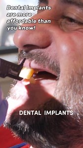 156 reactions · 11 shares |  혿홤 홉홤황 홋홖홮 $2,000 per Implant: Full mouth or single tooth procedures (pricing on the next page)  | Body Hacks | Facebook