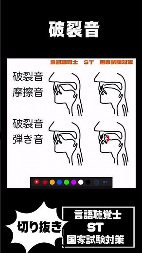 一貫性と被刺激性 小児の構音訓練