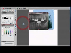 SilverFast X-Ray 8 - Scanner Software for X-Ray Images (English)