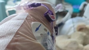 ‘I almost died:’ Troubling number of Canadian seniors struggle to recover from surgery, study suggests