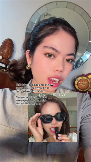 Transformation: My Journey with Thyroid Issues