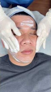 Quy trình cải thiện da