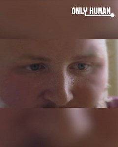 12K views · 28 reactions | Dan suffers from eczema and is given a mineral mud treatment to help his condition. He has always suffered with his skin but the stress of adult life has seen the condition deteriorate. From: The Spa of Embarrassing Illnesses S1 Ep5 | Only Human | Facebook