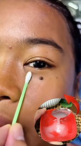 138K views · 549 reactions | How to Remove Warts, Skin Tags Easily at Home _ Quick & Effective Methods #WartRemoval #ClearSkin #naturaltips #warts #skintags | Bright Star | Facebook