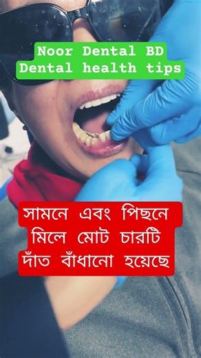 Dental Denture Teeth ‪@DentalHealthTips‬