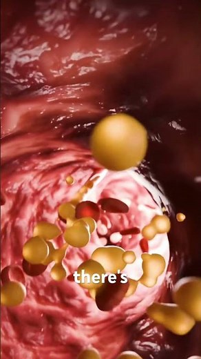 How insulin pump works?3d animation #insulinpump #insulinpatch #dysglycemia #typeone