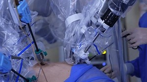 Robotic Manipulator Arms Carry Out Laparoscopic Stock Footage Video (100% Royalty-free) 1101629563 | Shutterstock