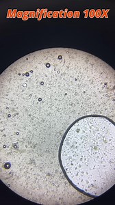 Magnification 100X #biologyquiz #neet #biology #biologyfacts #biologystudent #biologyquestions #genetics #neetpreparation #biologynotes #biologystudents #neetbiology #biologymeme #biologyclass #neetexam #biologylovers #mbbs #science #microbiology #biologyteachers #biologyislife #biologylab #quiz #learn #neetquestions #biochemistry #botany #mathematicalscience #molecularbiology #electronicscience #icaiexams | Medical Student