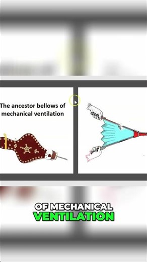 ICU Ventilation: Pressure Support & Assist Control Explained #shorts