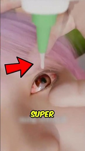 Super Glue in Your Eye! 🚨 Do THIS Immediately Most People Get It Wrong