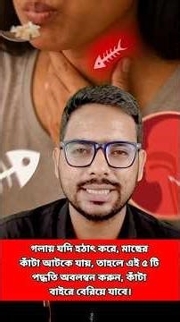 S.192||Fish Bone stuck in throat??#shorts,#shortvideo,#healthtips,#drmohofilmondal..