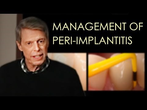 Management of Peri-implant Disease (Updated)