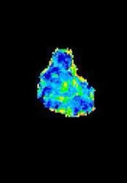 Rac activity in a primary chemotaxing neutrophil