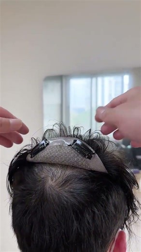 Revolutionary Hair Loss Solutions for Men - Custom Wigs Unveiled