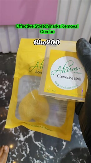 Best Stretchmarks Treatment Combo for Clear Skin