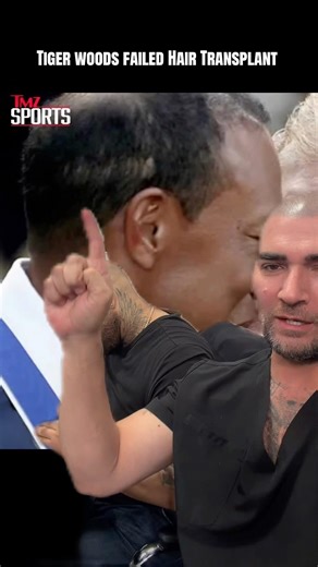Tiger Woods Botched Hair Transplant