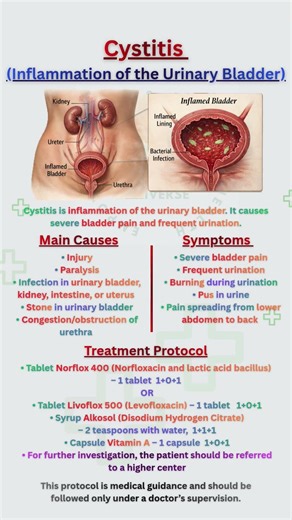 "Cystitis Explained: Bladder Pain & Symptoms" #Cystitis #UrinaryHealth #BladderPain