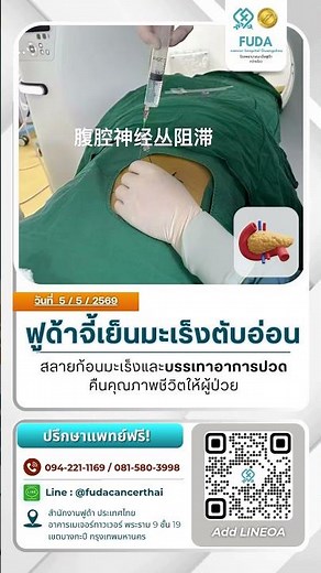 ✨ฟูด้าจี้เย็นมะเร็งตับอ่อน สลายก้อนมะเร็งและบรรเทาอาการปวดคืนคุณภาพชีวิตให้ผู้ป่วย✨