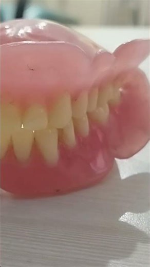 BPS dentures #viral #dentalcare #video #shorts #shortvideo#ytshorts #yt