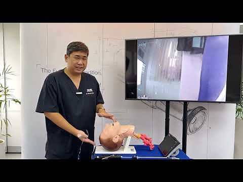 How to perform Retromolar Intubation