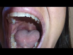 Getting used to using a torch. More will come.