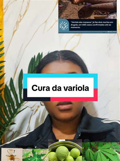 FAÇA ESTA ORAÇÃO DURANTE 7 DIAS. E TRAGA TESTEMUNHO 🔥 Tiago 5:14-15 14 Está alguém entre vós doente? Chame os presbíteros da igreja, e orem sobre ele, ungindo-o com azeite em nome do Senhor; 15 e a oração da fé salvará o doente, e o Senhor o levantará; e, se houver cometido pecados, ser-lhe-ão perdoados. Jeremias 17:14 14 Sara-me, Senhor, e sararei; salva-me, e serei salvo; porque tu és o meu louvor. Salmos 30:2 2 Senhor, meu Deus, clamei a ti, e tu me saraste. #alertainternacional #cura #foryo